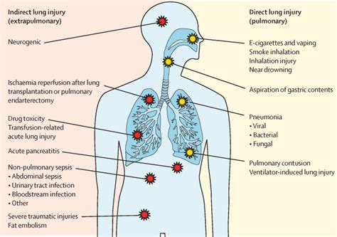 respiratory distress after chest trauma